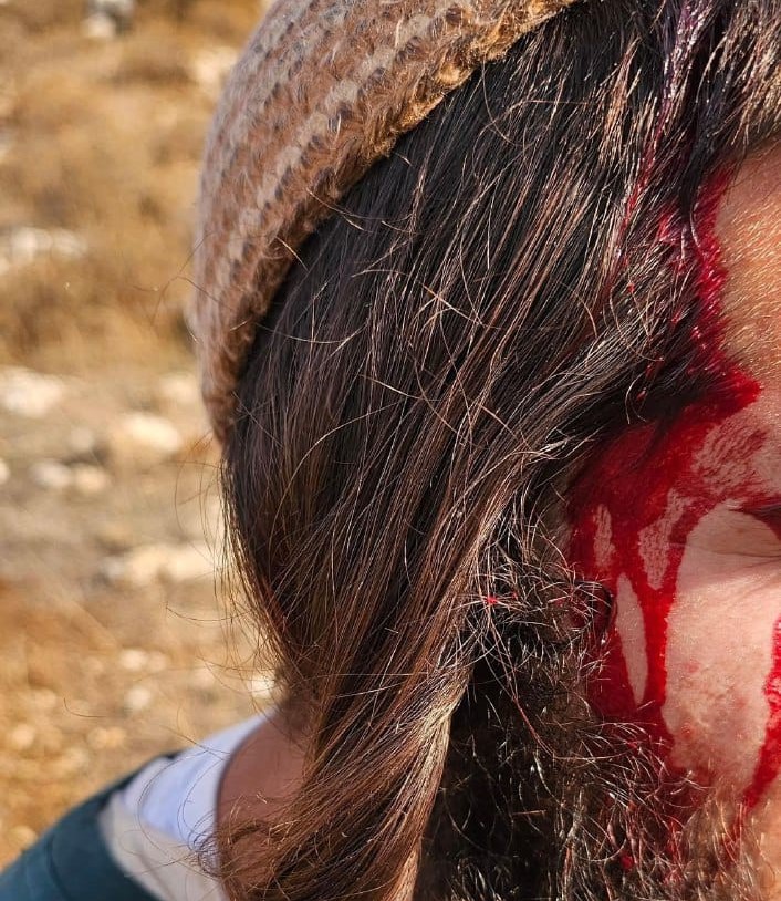 אלימות נגד רועי צאן