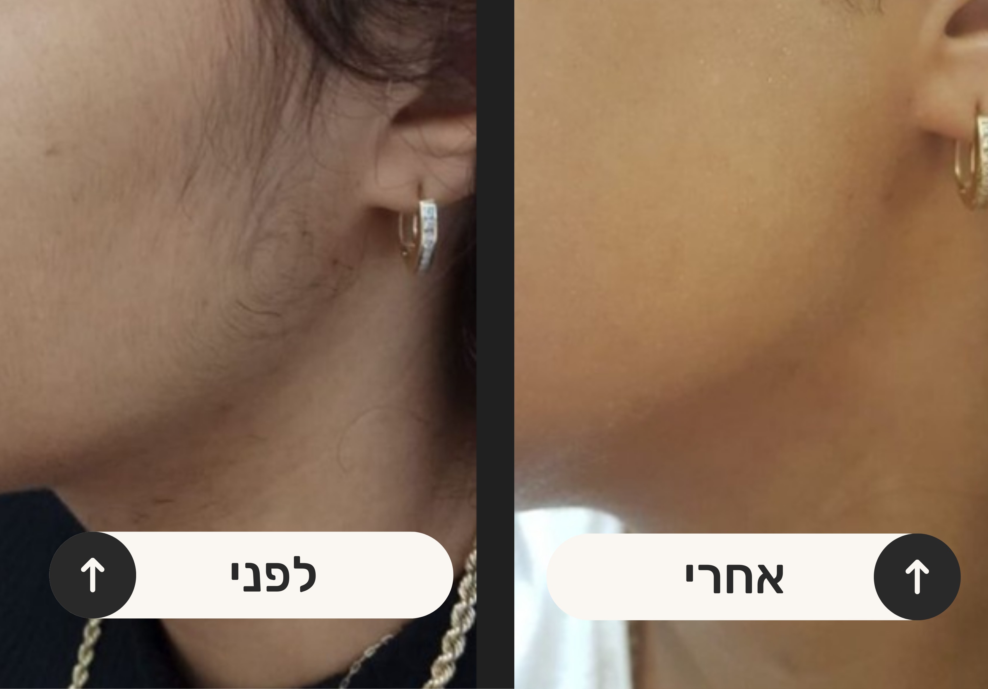 לפני ואחרי הטיפול