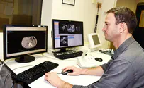 מחקר חדש יטמיע בינה מלאכותית ב-MRI
